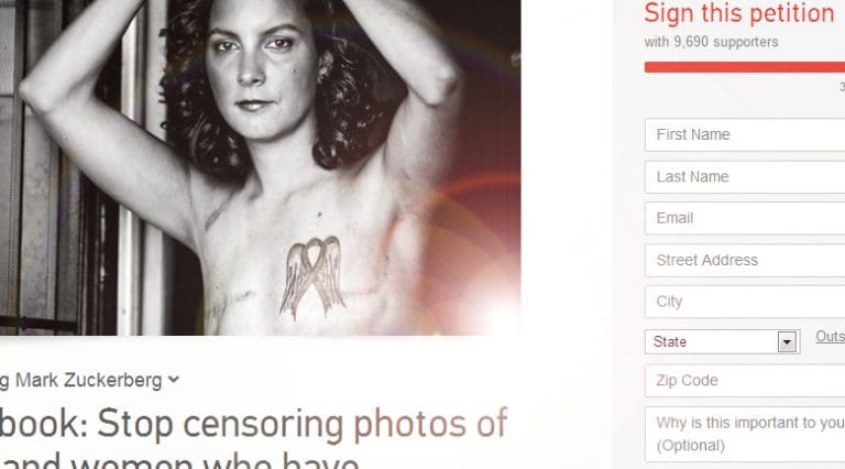 Facebook bans mastectomy photos as porn, then says oops