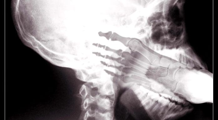 marketing-typos marketing typos